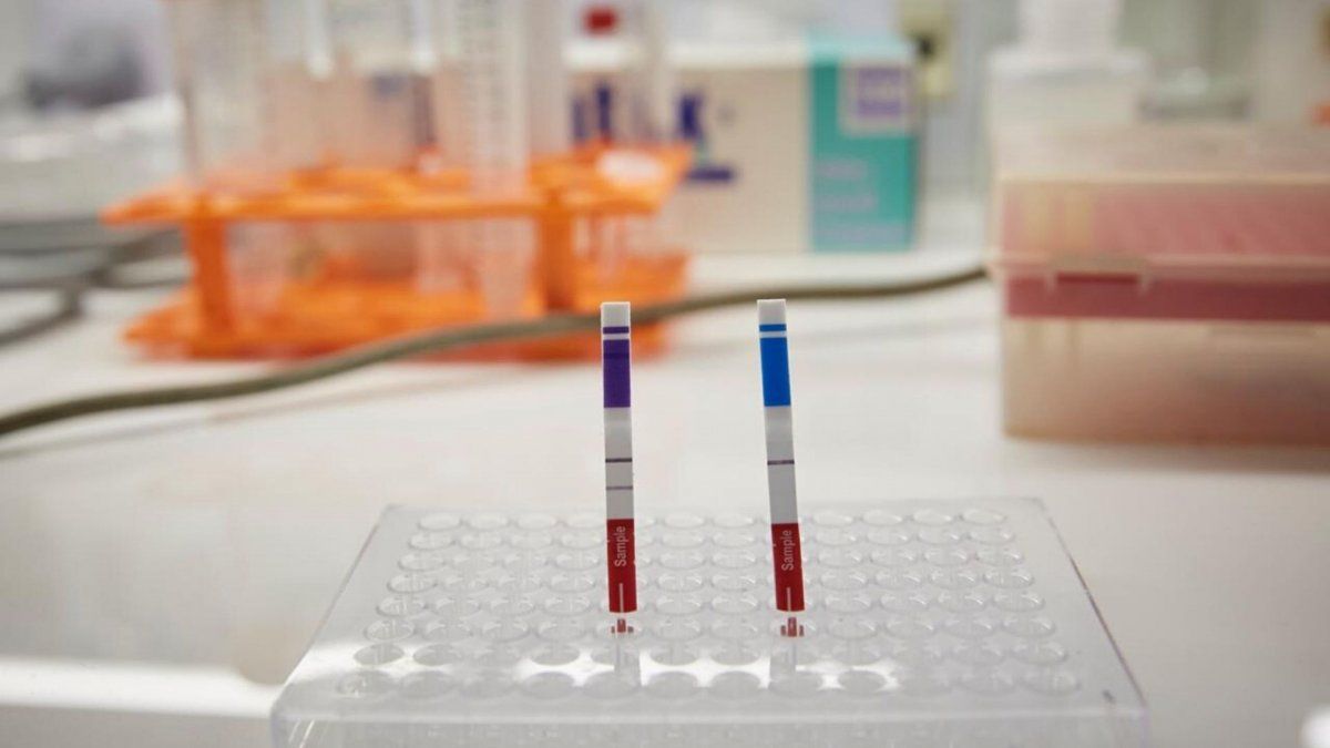 Con un desarrollo totalmente nacional, producirán nuevo kit PCR ...
