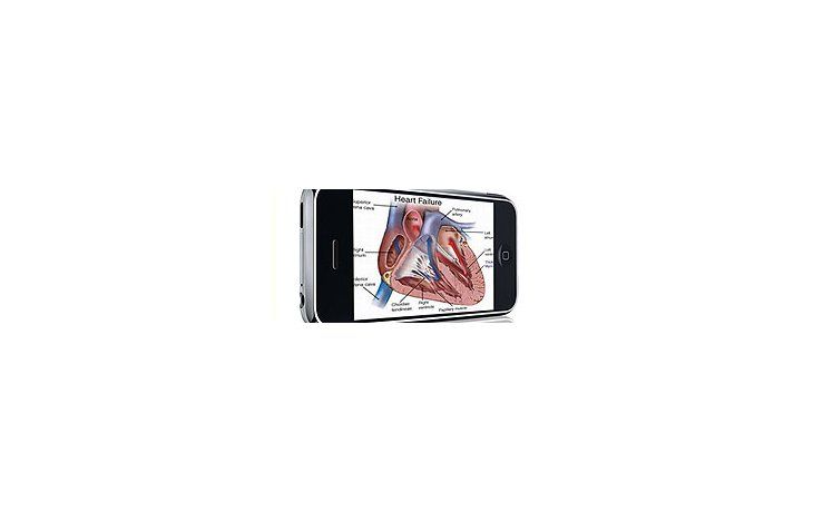 iPhone y computadoras pondrían en forma al corazón