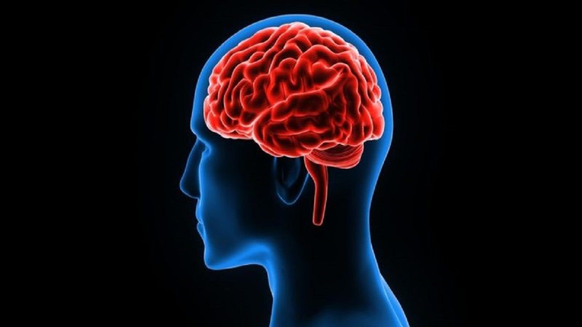 Altamirano’s health: what is a cerebral venous sinus thrombosis?