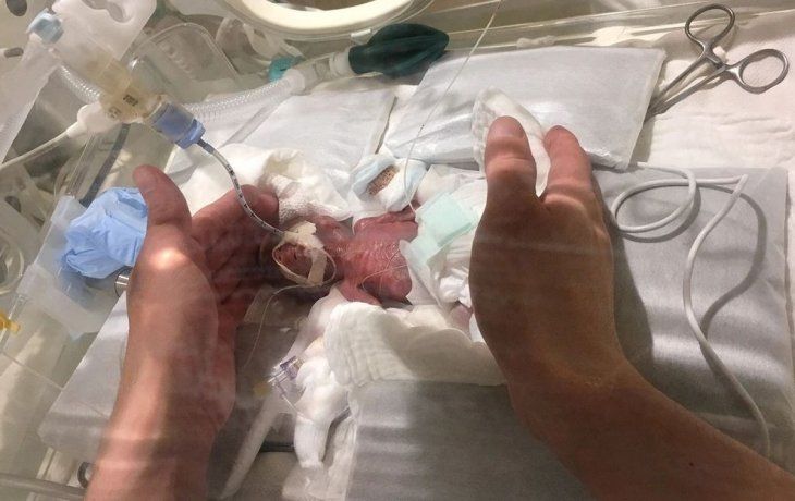 Dieron de alta al bebé más pequeño del mundo: pesó 268 gramos al nacer