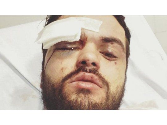 Brutal ataque homofóbico a un joven en Palermo