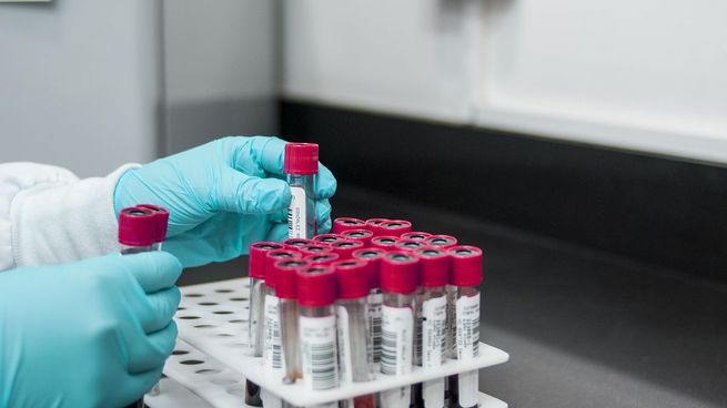 Hallazgo de la Universidad de San Martín y del Hospital Oftalmológico Santa Lucía.