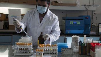 Así se midió el cortisol en cabello para determinar el estrés del personal de salud. Así se midió el cortisol en cabello para determinar el estrés del personal de salud.