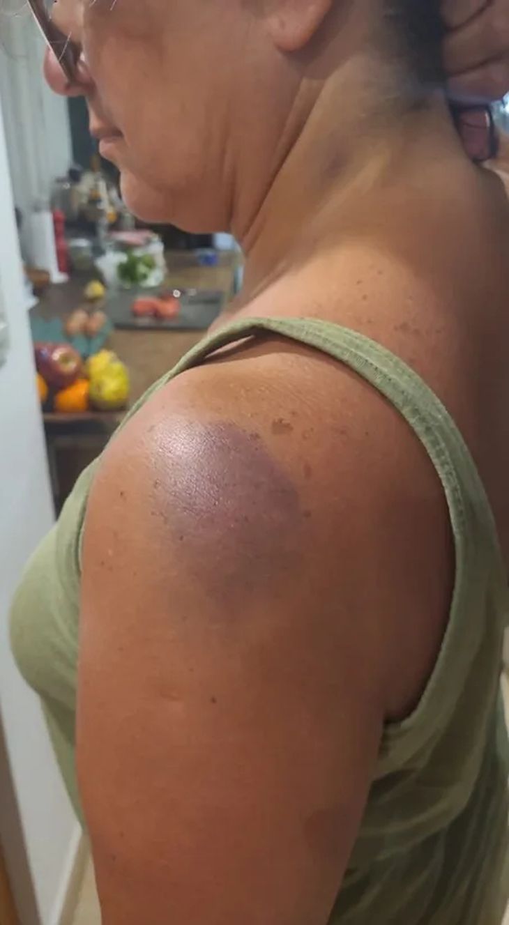 This is how the victim's body looked like after the attack. This is how the victim's body looked like after the attack.