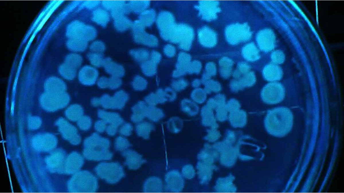 They warn that deaths due to infection with resistant bacteria will increase