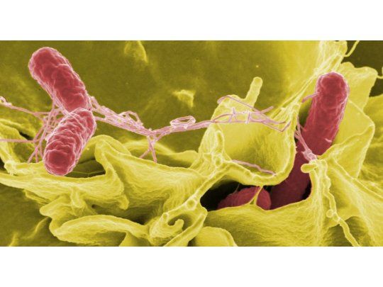  Esta es la bacteria más peligrosa del mundo: provoca infecciones en heridas y pulmones