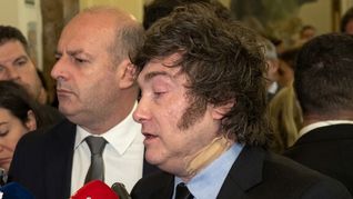 Según el Gobierno, Javier Milei sufrió un golpe al salir de la bañera, provocándole un hematoma en el cuello.