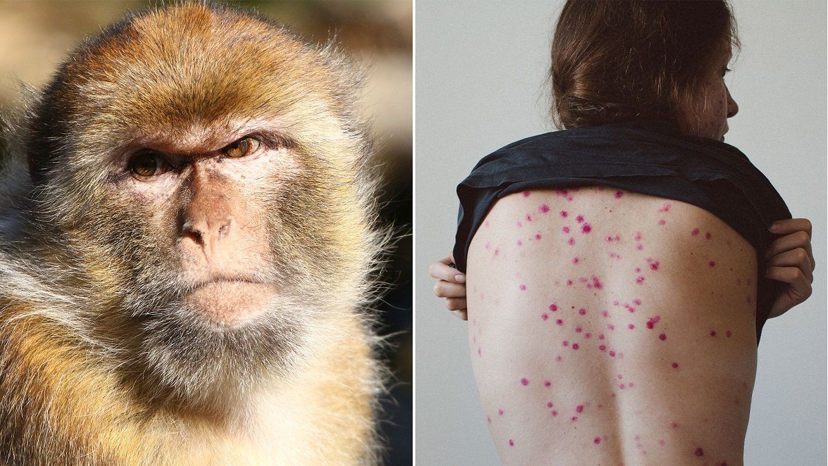 First death from monkeypox confirmed in Europe