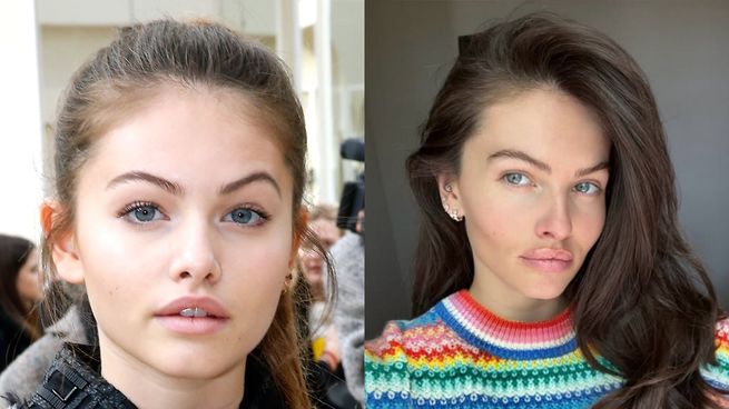 He reappeared “the prettiest girl in the world” and denied having performed aesthetic surgeries