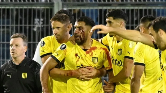 Un proyectil impactó en el rostro de Maximiliano Olivera durante el partido por Copa Libertadores entre Rosario Central y Peñarol.