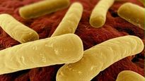 El botulismo es una enfermedad grave asociada al consumo de alimentos mal procesados, especialmente conservas caseras.