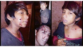 Exceso en Formosa