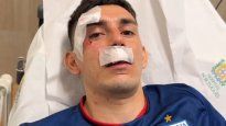 El futbolista argentino Gonzalo Escobar resultó herido por el ataque al micro de Fortaleza.