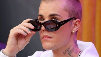 la enfermedad de justin bieber puede traer graves consecuencias para la vista