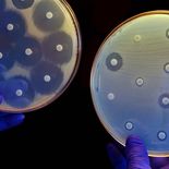 Un modelo de inteligencia artificial permitió diseñar nuevas moléculas contra bacterias resistentes. Un modelo de inteligencia artificial permitió diseñar nuevas moléculas contra bacterias resistentes.