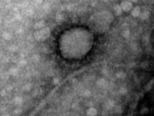 La imagen microsc&oacute;pica del coronavirus pertenece al Instituto ANLIS Malbr&aacute;n y al Conicet.