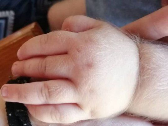 Los afectados son al menos 17 niños