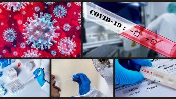 covid-19: reactivos autorizados por la anmat y el ministerio de salud