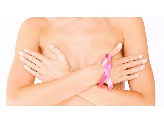 Alternativas de reconstrucción mamaria tras un cáncer