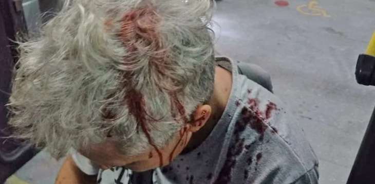 Colectivero agredido.