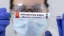 The World Health Organization (WHO) declared monkeypox an international health emergency. The World Health Organization (WHO) declared monkeypox an international health emergency.