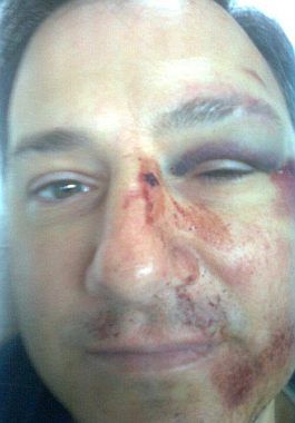 Brutal agresión a docente: Te vamos a matar, no sabés con quién te metiste (foto 1)