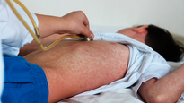 Sarampión en México: cuáles son los estados y municipios con mayor casos de contagios y muertes hoy, 10 de febrero 2026.