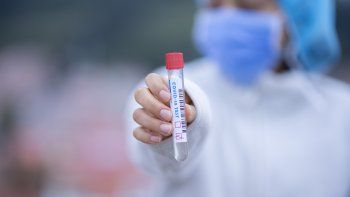 El nuevo test del INTI revela si el paciente perdió el olfato, uno de los síntomas más comunes del coronavirus.