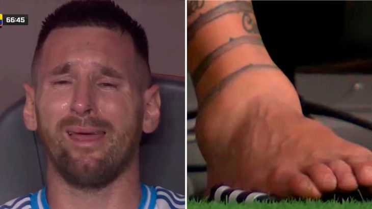 Inter Miami confirmó que Lionel Messi sufrió una lesión ligamentaria en el tobillo derecho