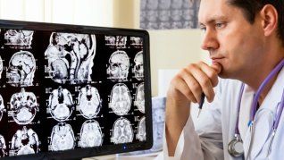 “No estamos curando la enfermedad, pero es la primera vez en la historia de la humanidad que conseguimos ralentizar el curso de la enfermedad de Alzheimer, enfatizó Juan Fortea, jefe del grupo de Neurobiología de las Demencias del Instituto de Investigación Sant Pau y coautor de uno de los artículos de la serie de The Lancet.
