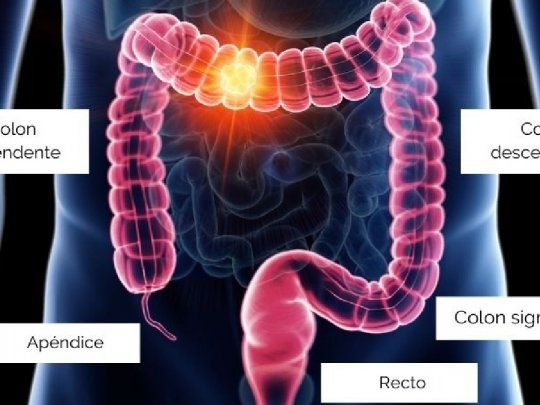 Tratamiento contra cáncer de colon. 