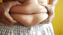 &nbsp;El avance de la UNAM en la lucha contra la obesidad