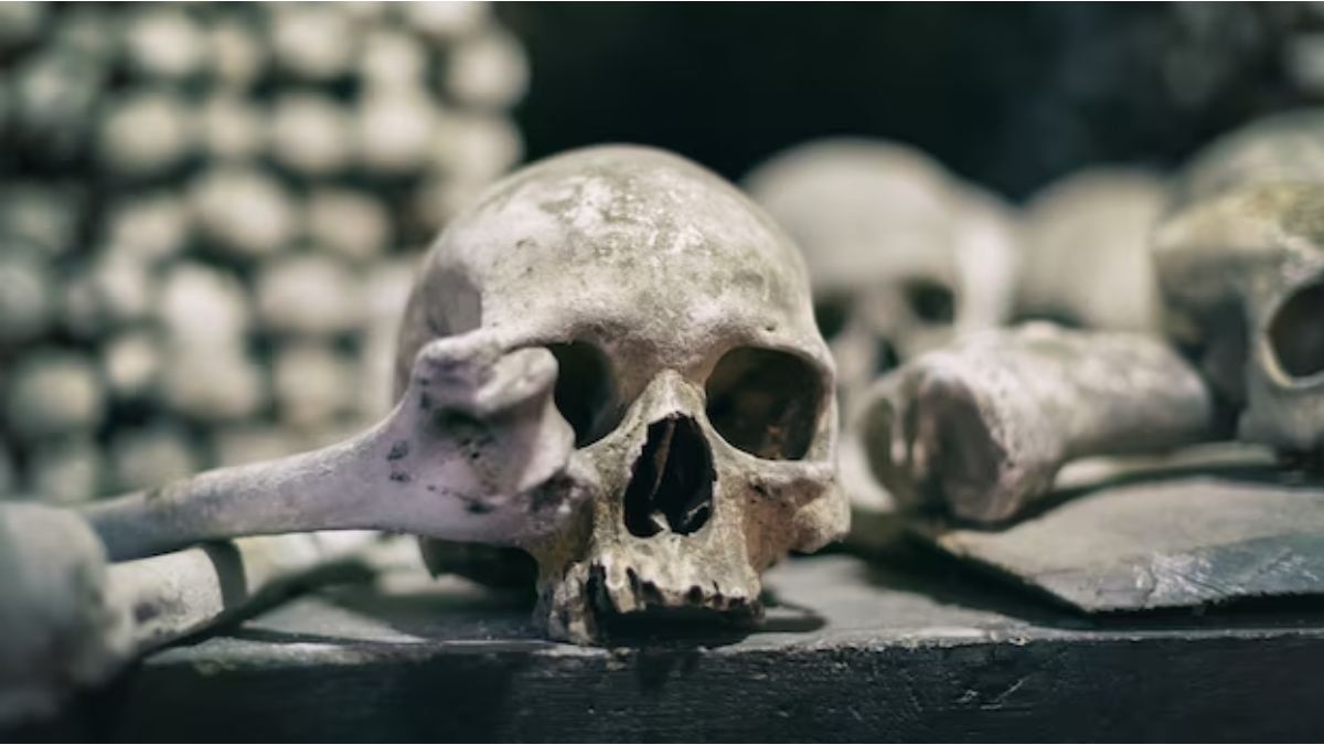 A 4,600-year-old skull revealed that the Egyptians tried to operate on cancer
