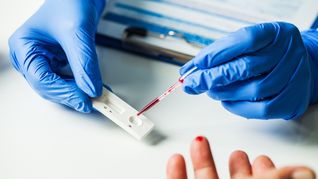 Innovación y detección temprana, las claves en la lucha contra el VIH