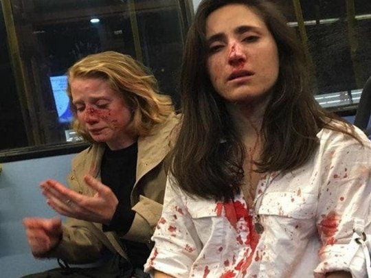 Melania Geymonat (derecha) y su pareja Chris, tras el ataque ocurrido en marzo pasado. 