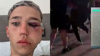cuatro rugbiers de un club salteno seran imputados por agredir a un menor en una fiesta