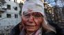 Una mujer, víctima de los ataques de Rusia en Donbás.