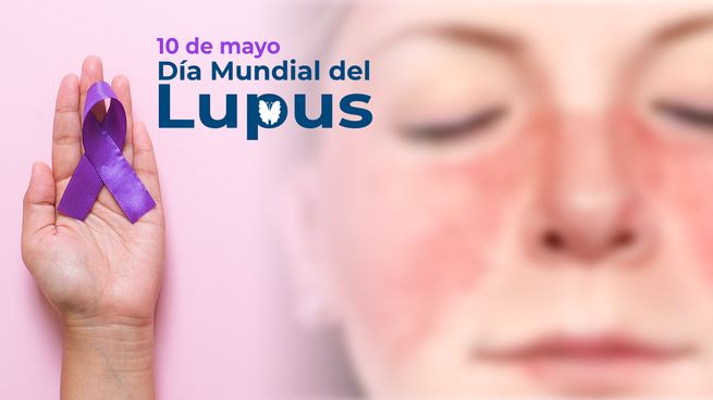 Imagen promocional de la campaña del Día Mundial del Lupus