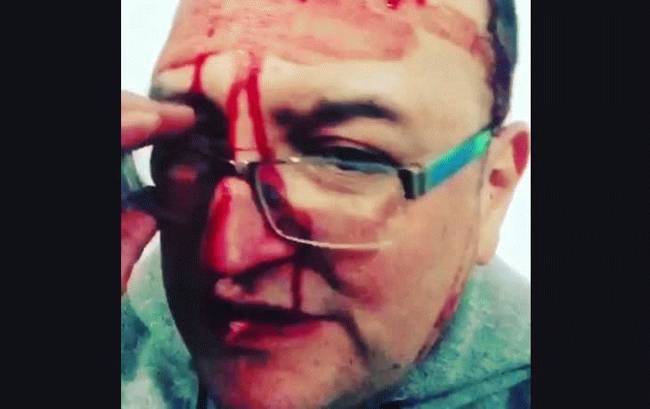 Leo García sufrió un brutal ataque homofóbico por parte de una patota