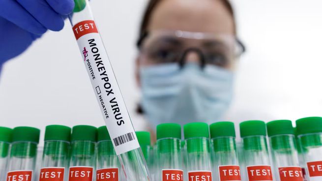 La Organización Mundial de la Salud declaró al nuevo brote de viruela del mono como emergencia sanitaria a nivel mundial.