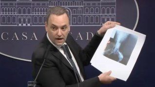 Manuel Adorni, cuando confundió la radiografia de un perro con la de una personal. El vocero suspendió las conferencias de prensa y es un activo tóxico de La Libertad Avanza. Manuel Adorni, cuando confundió la radiografia de un perro con la de una personal. El vocero suspendió las conferencias de prensa y es un activo tóxico de La Libertad Avanza.