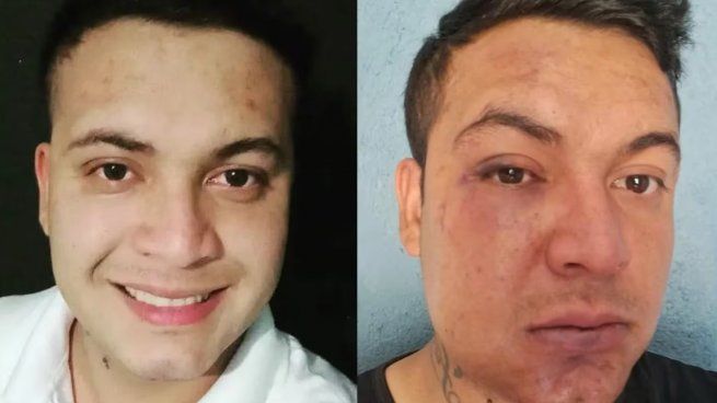 El antes y el después de la brutal golpiza que recibió 