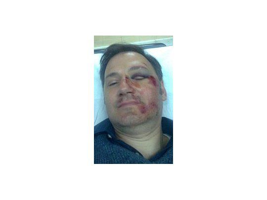 Ricardo Fusco difundió las fotos tras la agresión en su perfil de Facebook