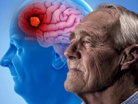 Un alimento que combate el Alzheimer, según Harvard.