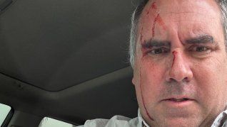 Rafael Belaúnde Llosa fue víctima de una balacera en Perú.