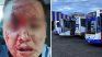 A driver of line 338 was hit in the head by a bottle A driver of line 338 was hit in the head by a bottle
