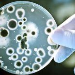 Se trata de una bacteria que cuenta con una memebrana unida a su pared molecular. Se trata de una bacteria que cuenta con una memebrana unida a su pared molecular.