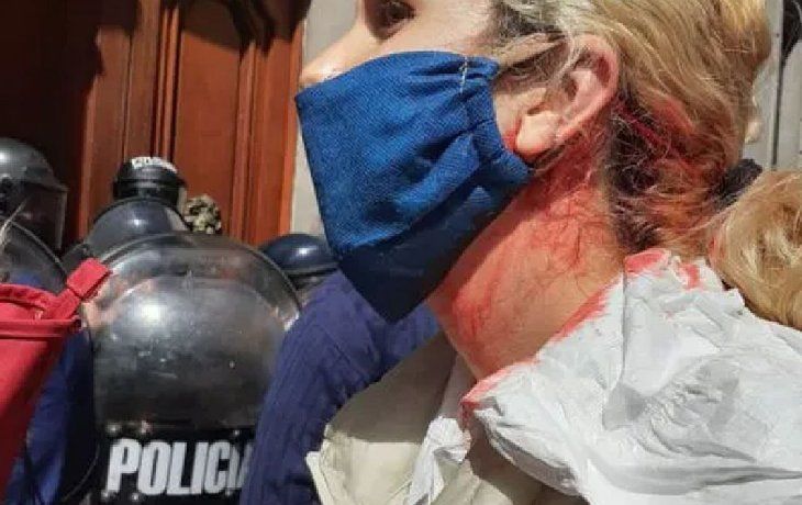 Queríamos entregar un petitorio a los legisladores y los policías nos agredieron, sostuvo Cáceres.