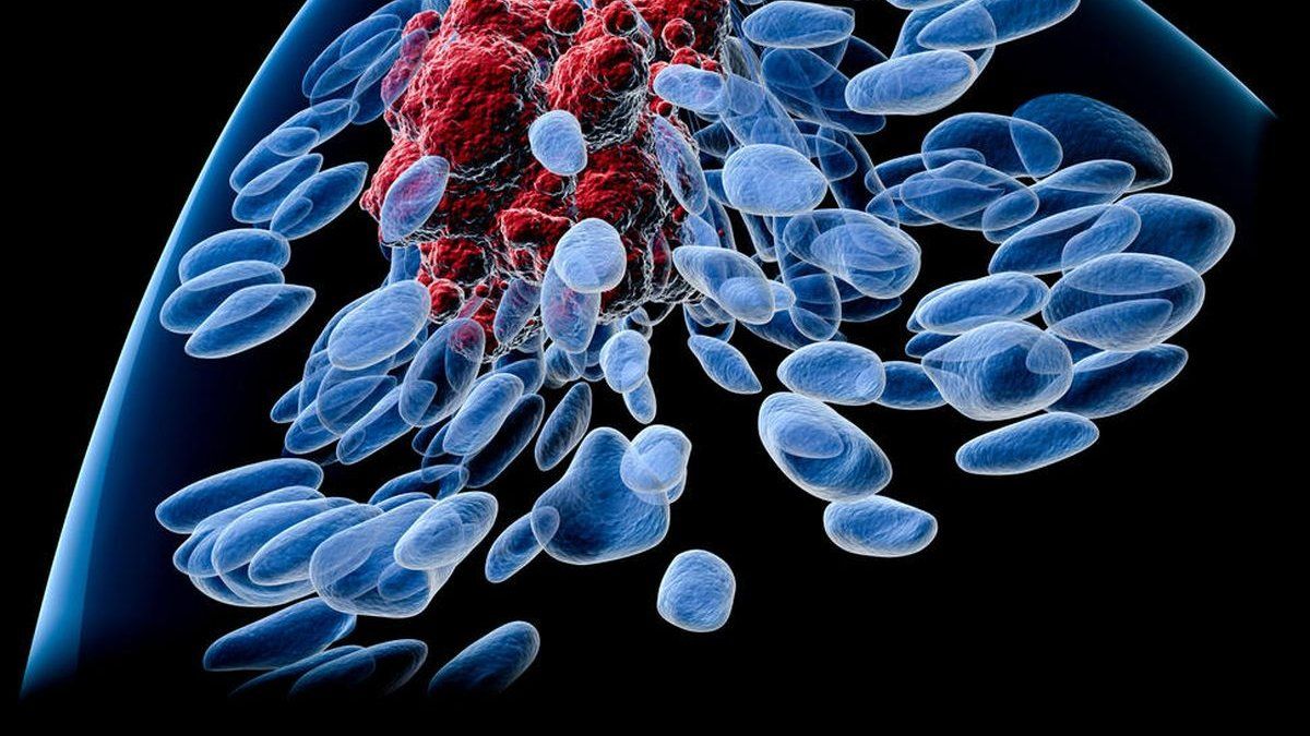 Cáncer de mama: una nueva droga disminuye en un 30% el riesgo de recurrencia