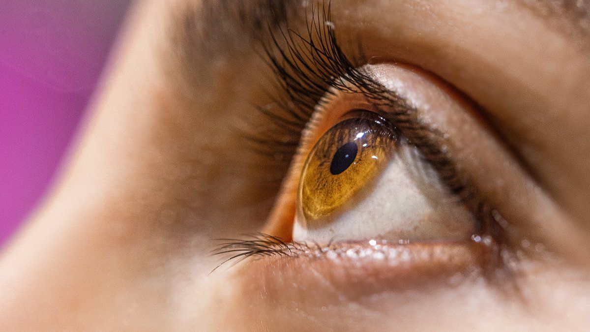 It looks like dry eye, but it’s something else